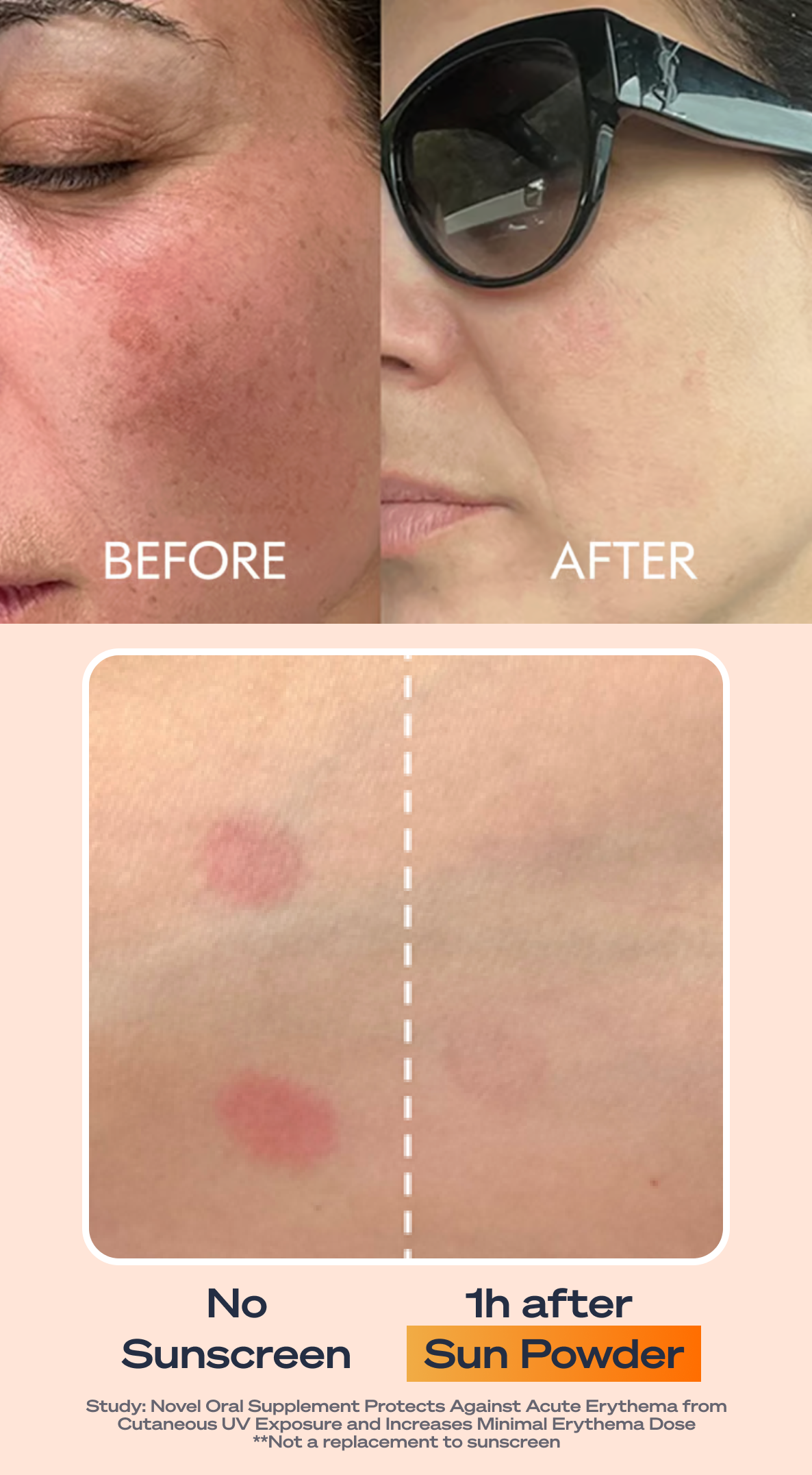 Before and after clinical results showing reduced UV-induced skin redness with Sun Powder